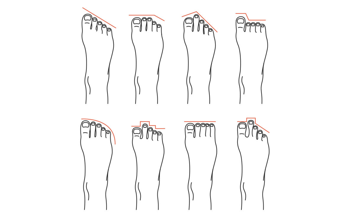 Different foot shapes
